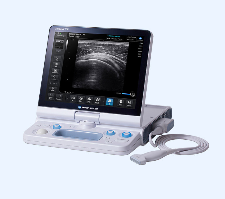 超音波診断装置の写真