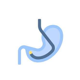 胃カメラを表す内視鏡検査のイラスト画像